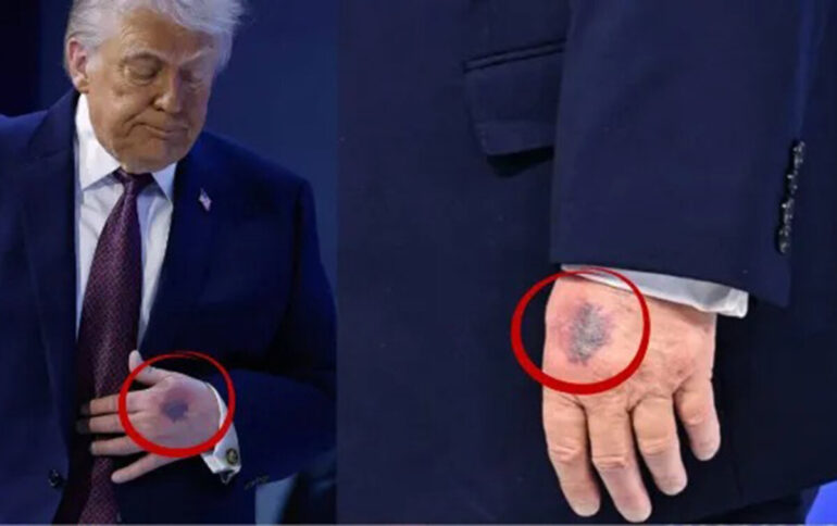 Trump 1 scaled